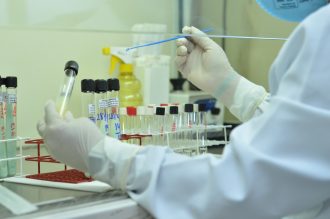 zika-exames