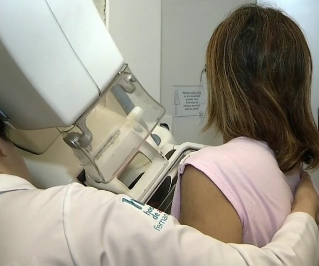 mamografia